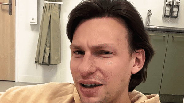 maxim-fue-ct-haartransplantatie